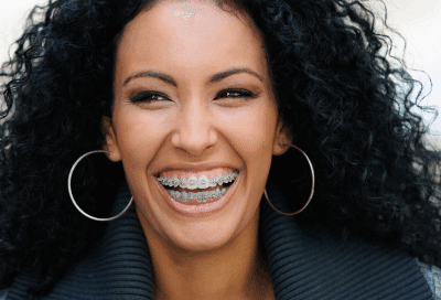 The best types of braces for adults 7 Woman smiling while wearing braces, representing braces for adults