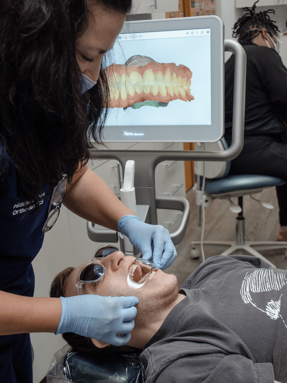 Itero-hidden-smiles Itero-scanner-advanced-technology